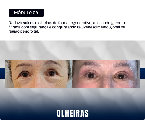 09.webp